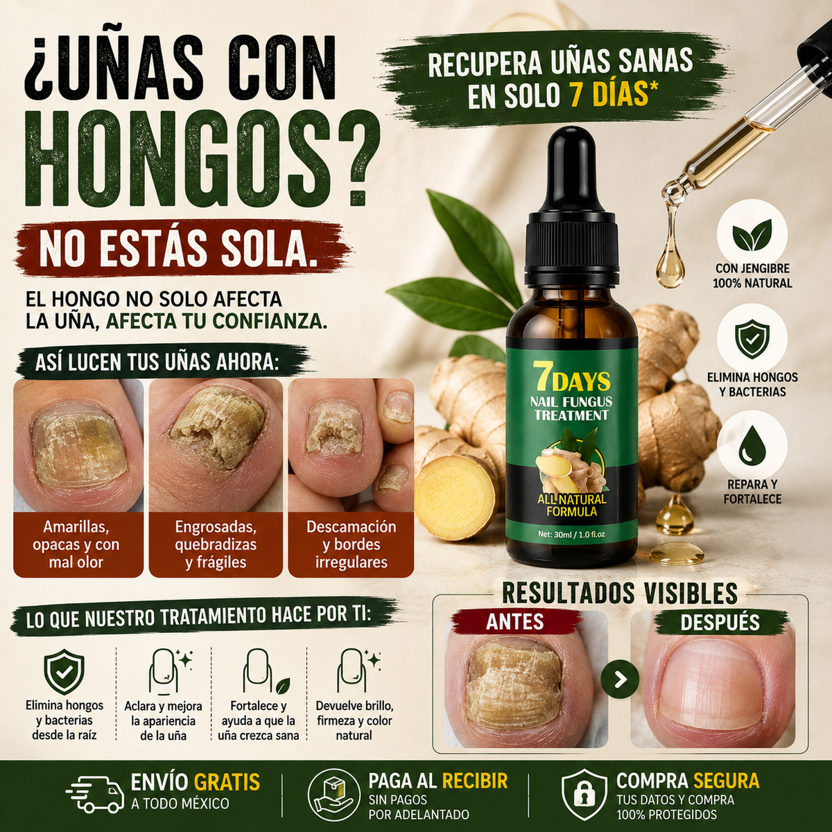 GingerNails™ - Sérum Antifúngico 14 Dias