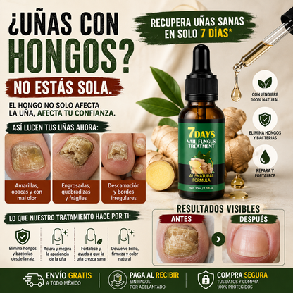GingerNails™ - Sérum Antifúngico 14 Dias